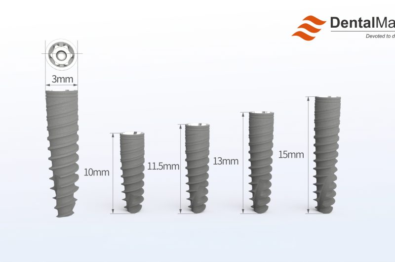 mini dental implants