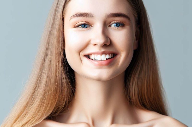 Self Ligating Braces