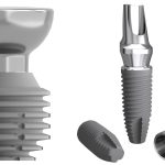 What Do Dental Implants Look Like?