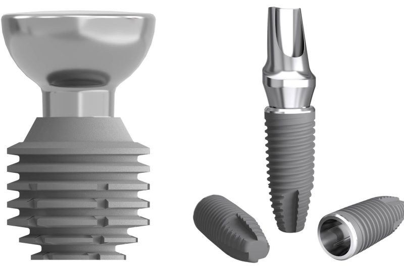 What Do Dental Implants Look Like?