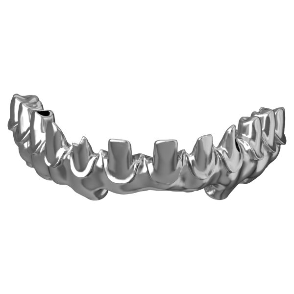 milled titanium implant bridge