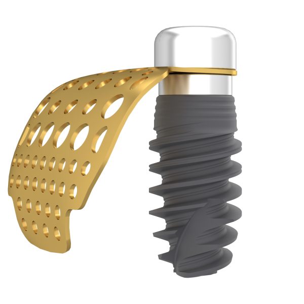 GBR Connection Abutment - Image 3
