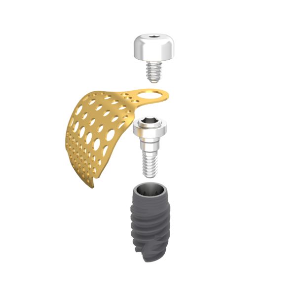 GBR Connection Abutment - Image 2