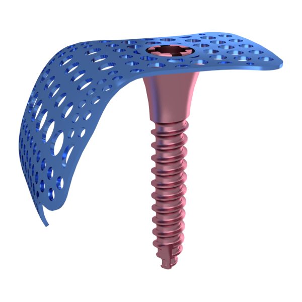 Membrane Fixation Screw - Image 3