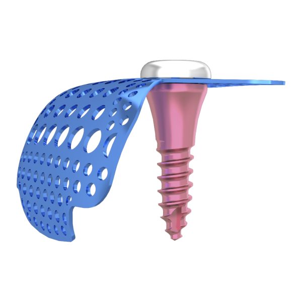 Membrane Fixation Screw - Image 4