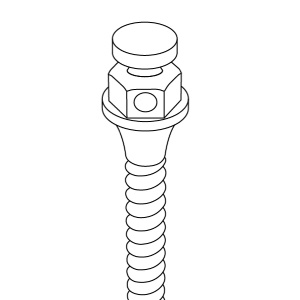 Orthodontic Micro-Implants (TADs)